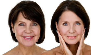 The 4 Different Wrinkle Types and How to Treat Each One Christina France