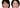 The 4 Different Wrinkle Types and How to Treat Each One Christina France