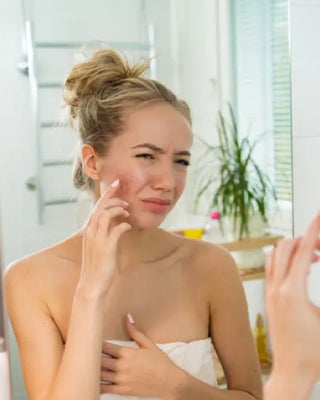 An Inside Look at Acne Christina France