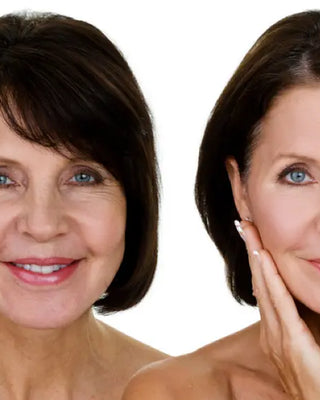 The 4 Different Wrinkle Types and How to Treat Each One Christina France